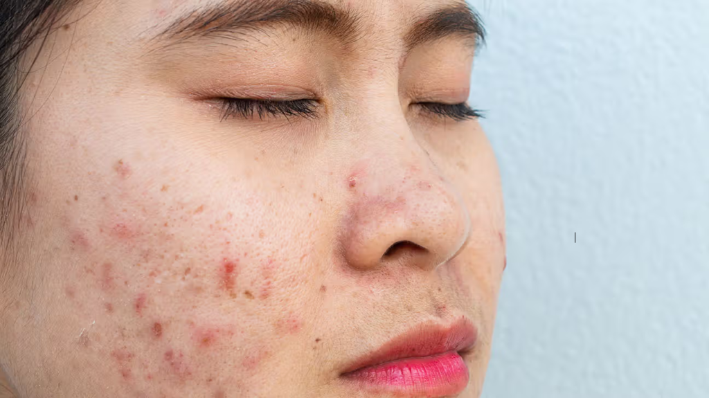 Close-up of skin with visible irritation, showing redness, bumps, and dryness, indicating possible skin issues or conditions.